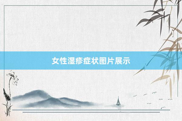 女性湿疹症状图片展示